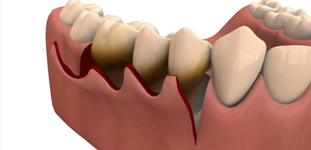 Periodontics