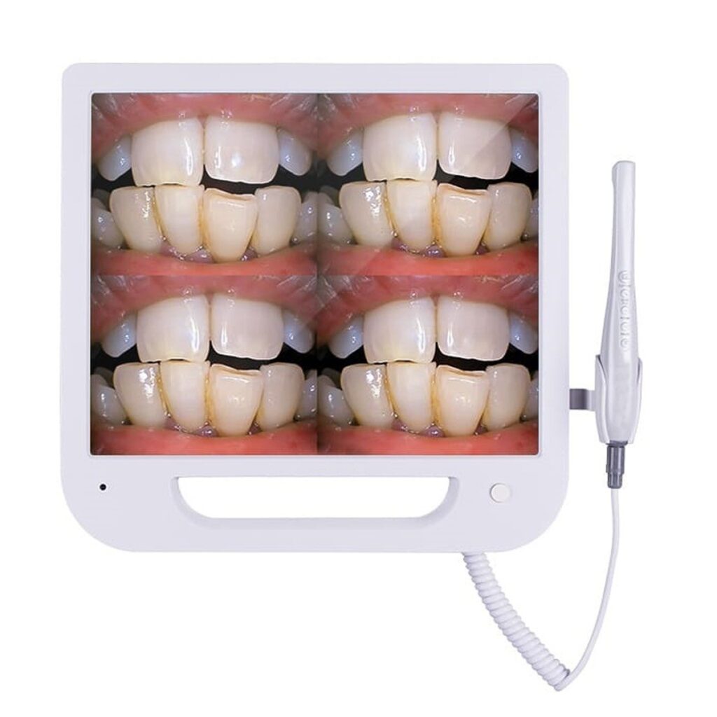 🔎 Intraoral Cameras